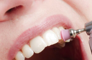 Precio de una Limpieza Dental